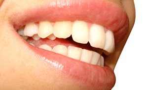 Smil