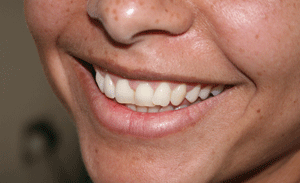 Smil